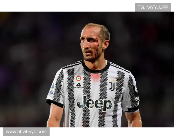 基耶利尼：我从不对球员发脾气；尤文最后一块拼图是体育总监